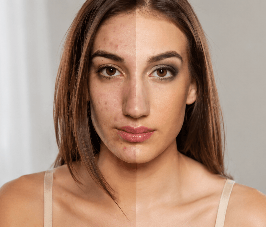 The Best Skin Renewal Products Can Improve Skin Health After a Busy Week