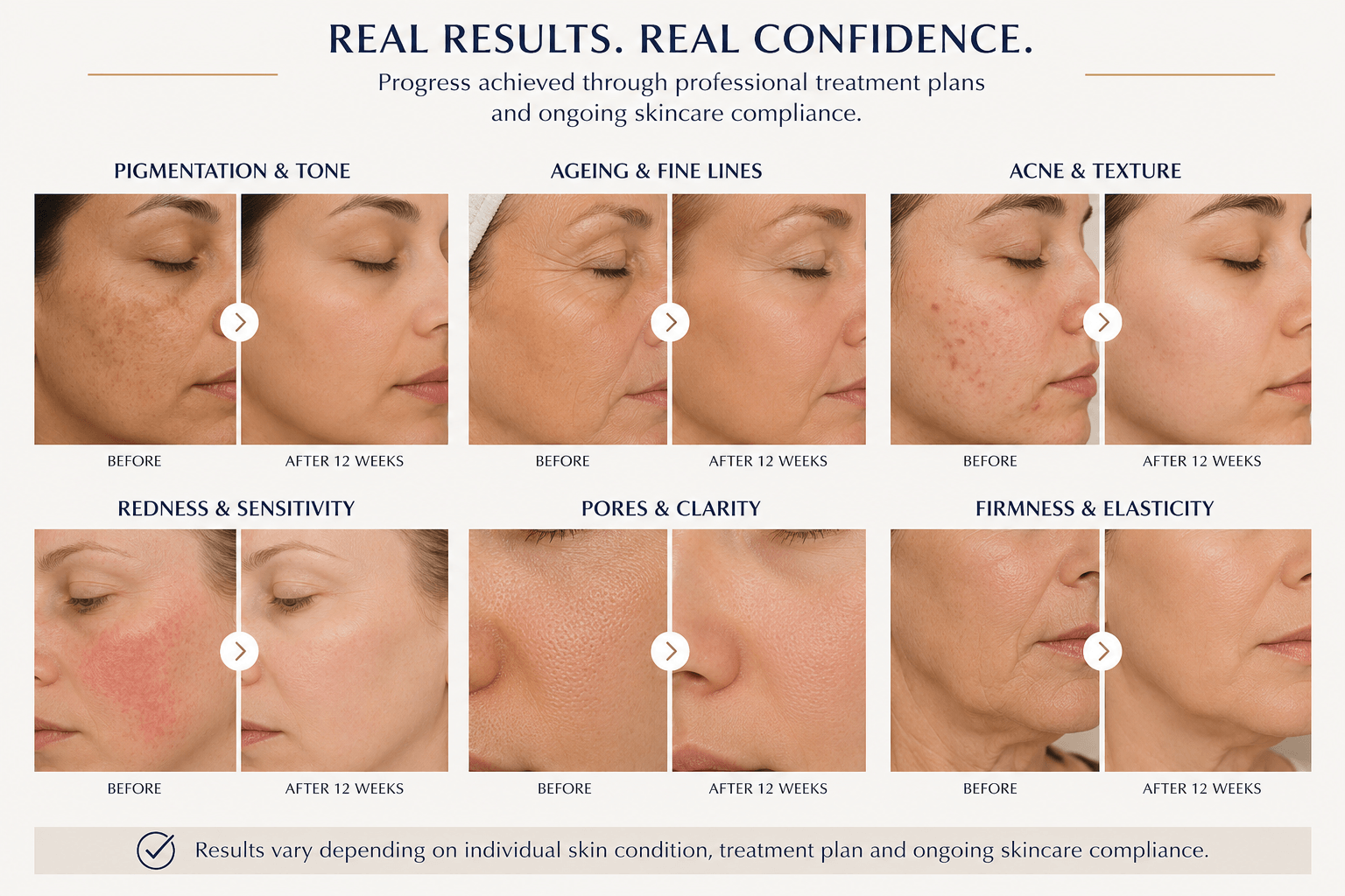 Progress images showing skin improvements achieved through professional treatment plans and ongoing skincare compliance